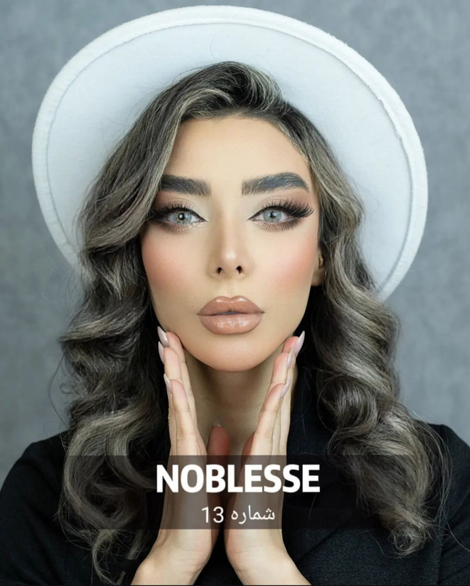 لنز چشم کره ای نابلس شماره 13