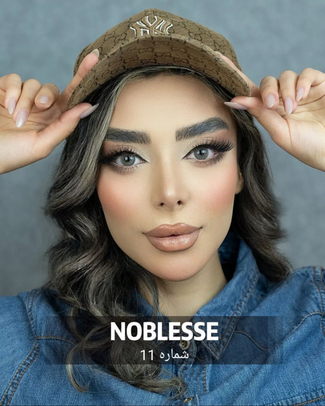 لنز چشم کره ای نابلس شماره 11