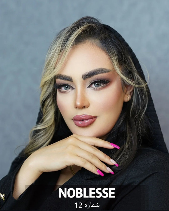 لنز چشم کره ای نابلس شماره12