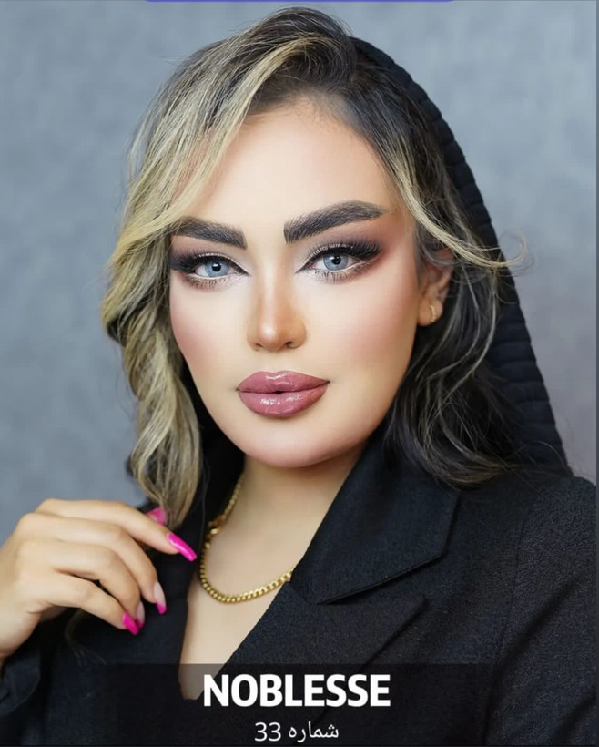 لنز چشم نابلس محصول کره شماره 33