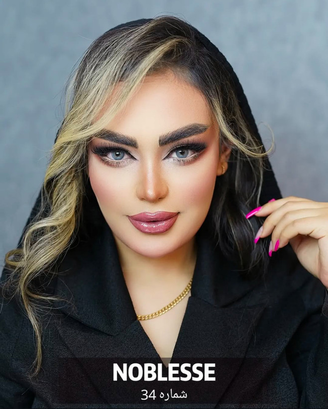 لنز چشم نابلس محصول کره شماره 34