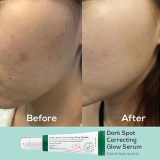 سرم ضد لک اکسیس وای اورجینال تضمینی مدل Dark Spot حجم 50 میلی لیتر