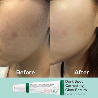 سرم ضد لک اکسیس وای اورجینال تضمینی مدل Dark Spot حجم 50 میلی لیتر